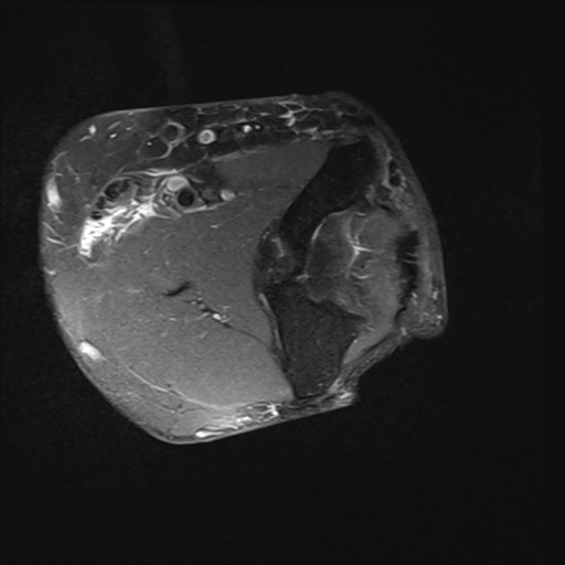 Click on the Serie image to view the images of Wieszt, Gnter